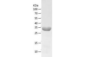 Western Blotting (WB) image for ADP-Ribosylation Factor-Like 5B (ARL5B) (AA 1-299) protein (His tag) (ABIN7121749) (ARL5B Protein (AA 1-299) (His tag))