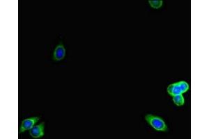Immunofluorescent analysis of HepG2 cells using ABIN7157938 at dilution of 1:100 and Alexa Fluor 488-congugated AffiniPure Goat Anti-Rabbit IgG(H+L) (LTBP4 抗体  (AA 977-1180))