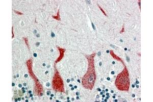 ABIN185366 (4µg/ml) staining of paraffin embedded Human Cerebellum. (Retinoic Acid Receptor alpha 抗体  (C-Term))