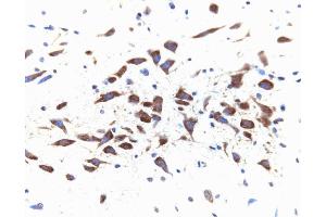 Immunohistochemical staining for Dynamin II on a rat brain section, zinc-fixed paraffin-embedded (40X magnification). (DNM2 抗体  (AA 274-555))