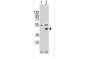 Western blot analysis of WIF1 (arrow) using rabbit polyclonal WIF1 Antibody (N-term) (ABIN389184 and ABIN2839347). (WIF1 抗体  (N-Term))