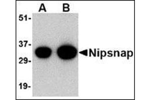 Western blot analysis of NIPSNAP in human brain tissue lysate with this product at (A) 0. (NIPSNAP1 抗体  (C-Term))
