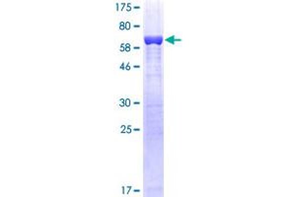 GMDS Protein (AA 1-372) (GST tag)