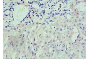 Immunohistochemistry of paraffin-embedded human liver tissue using ABIN7161434 at dilution of 1:100 (Neuropilin 1 抗体  (AA 684-923))