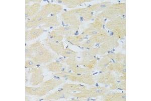 Immunohistochemistry of paraffin-embedded mouse heart using CXCR3 Antibody. (CXCR3 抗体)