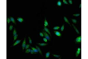 Immunofluorescent analysis of Hela cells using ABIN7154903 at dilution of 1:100 and Alexa Fluor 488-congugated AffiniPure Goat Anti-Rabbit IgG(H+L) (TRAP1 抗体  (AA 60-308))