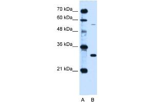 WB Suggested Anti-HFE Antibody Titration:  0. (HFE 抗体  (C-Term))