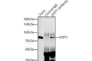 Immunoprecipitation analysis of 300 μg extracts of HeLa cells using 3 μg GFPT1 antibody (ABIN7267430). (GFPT1 抗体)