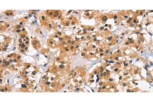 Immunohistochemistry (Paraffin-embedded Sections) (IHC (p)) image for anti-Calcium Channel, Voltage-Dependent, L Type, alpha 1C Subunit (CACNA1C) antibody (ABIN7238732)