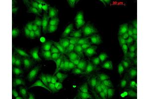 Immunocytochemistry/Immunofluorescence analysis using Rabbit Anti-HSP22 Polyclonal Antibody . (HSPB8 抗体  (Biotin))