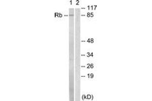 Western blot analysis of extracts from HeLa cells, treated with Calyculin A 50nM 30', using Retinoblastoma (Ab-811) Antibody.