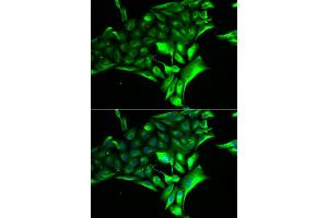 Immunofluorescence analysis of MCF-7 cell using PYGB antibody. (PYGB 抗体)