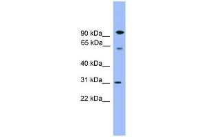 Western Blot showing CPNE6 antibody used at a concentration of 1-2 ug/ml to detect its target protein. (CPNE6 抗体  (Middle Region))