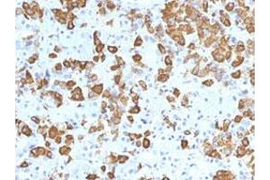 Immunohistochemical staining (Formalin-fixed paraffin-embedded sections) of human pituitary gland with GH1 monoclonal antibody, clone GH/1371 . (Growth Hormone 1 抗体  (AA 58-187))