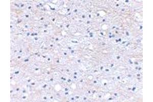 Immunohistochemical staining of human brain tissue using HAPLN2 polyclonal antibody  at 2. (HAPLN2 抗体  (Internal Region))
