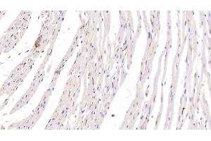 Detection of ADPN in Rat Heart Tissue using Monoclonal Antibody to Adiponectin (ADPN) (ADIPOQ 抗体  (AA 111-244))