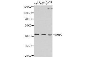 Western blot analysis of extracts of various cell lines, using BMP2 Antibody. (BMP2 抗体  (AA 283-396))