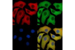 HtrA2 Mouse Monoclonal Antibody staining HepG2 cells by IF/ICC.