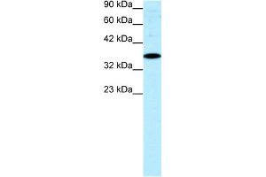 WB Suggested Anti-NR4A1 Antibody Titration:  0. (NR4A1 抗体  (N-Term))