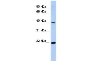 WB Suggested Anti-SSBP4 Antibody Titration:  0. (SSBP4 抗体  (Middle Region))