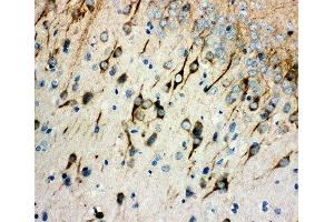 IHC-P: AChR antibody testing of rat brain tissue (CHRM1 抗体  (AA 303-317))