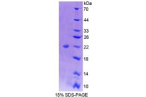 SDS-PAGE analysis of Human NFIA Protein. (NFIA 蛋白)