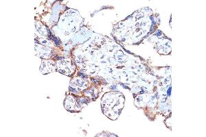 Immunohistochemistry of paraffin-embedded human placenta using ER Rabbit mAb (ABIN7266941) at dilution of 1:100 (40x lens). (ERAP1 抗体)
