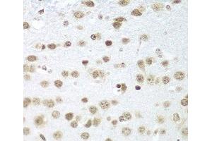 Immunohistochemistry of paraffin-embedded Mouse brain using SAP18 Polyclonal Antibody at dilution of 1:100 (40x lens). (SAP18 抗体)