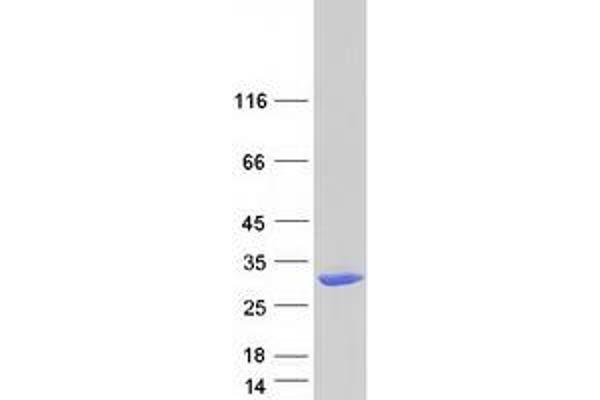DHRS11 Protein (Myc-DYKDDDDK Tag)