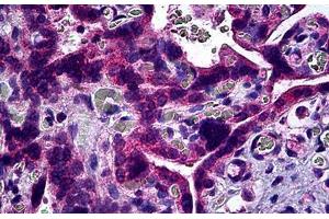 Human Placenta: Formalin-Fixed, Paraffin-Embedded (FFPE) (S1PR3 抗体)