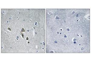 Immunohistochemistry (IHC) image for anti-Ornithine Decarboxylase Antizyme 1 (OAZ1) (N-Term) antibody (ABIN1851761) (OAZ1 抗体  (N-Term))