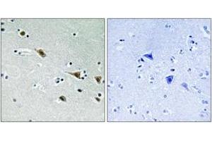 Immunohistochemistry (IHC) image for anti-Mitogen-Activated Protein Kinase Kinase 7 (MAP2K7) (AA 236-285), (pSer271) antibody (ABIN1532060)