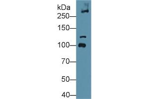 Detection of COL6a3 in Mouse Bladder lysate using Polyclonal Antibody to Collagen Type VI Alpha 3 (COL6a3) (COL6a3 抗体  (AA 2009-2205))