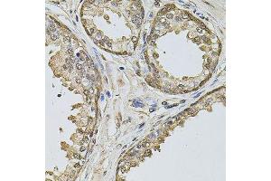 Immunohistochemistry of paraffin-embedded human prostate using CCNA2 antibody. (Cyclin A 抗体  (AA 1-200))