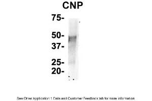 IP Suggested Anti-CNP Antibody    Positive Control:  NT2 CELL/BRAIN TISSUE (Cnpase 抗体  (N-Term))