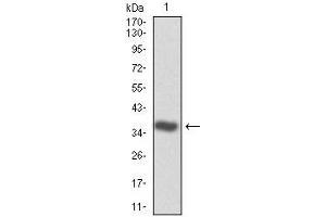 Western blot analysis using CDK2 mAb against human CDK2 (AA: 197-295) recombinant protein.