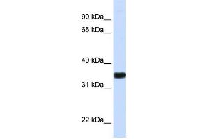 WB Suggested Anti-GAPDH Antibody Titration:  0. (GAPDH 抗体  (N-Term))