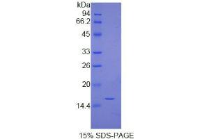 SDS-PAGE analysis of Human Immunoglobulin G4 Protein. (IgG4 蛋白)