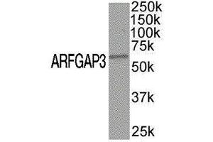 Western Blotting (WB) image for anti-ADP-Ribosylation Factor GTPase Activating Protein 3 (ARFGAP3) antibody (ABIN2477490) (ARFGAP3 抗体)