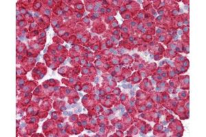 Anti-MDA5 antibody IHC of human pancreas. (IFIH1 抗体  (C-Term))
