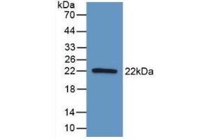 Detection of Recombinant AATK, Human using Polyclonal Antibody to Apoptosis Associated Tyrosine Kinase (AATK) (AATK 抗体  (AA 1216-1374))