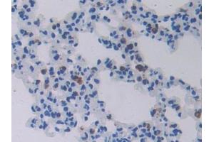 IHC-P analysis of Mouse Lung Tissue, with DAB staining. (CHI3L1 抗体  (AA 112-356))