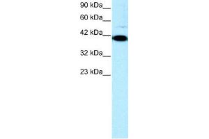 WB Suggested Anti-ZFP1 Antibody Titration: 0. (Zfp-1 抗体  (N-Term))