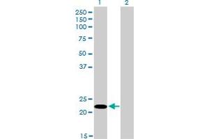 Western Blotting (WB) image for anti-serine/arginine-Rich Splicing Factor 10 (SRSF10) (AA 1-101) antibody (ABIN599153) (SRSF10 抗体  (AA 1-101))