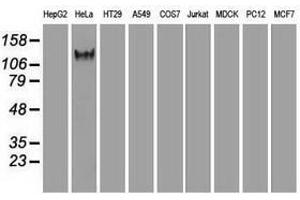 Image no. 6 for anti-L1 Cell Adhesion Molecule (L1CAM) antibody (ABIN1499089) (L1CAM 抗体)