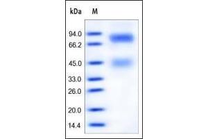 SDS-PAGE (SDS) image for Met Proto-Oncogene (MET) (AA 25-932) (Active) protein (His tag) (ABIN2180660)