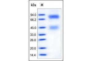 Human HGF R, His Tag on SDS-PAGE under reducing (R) condition. (c-MET Protein (AA 25-932) (His tag))