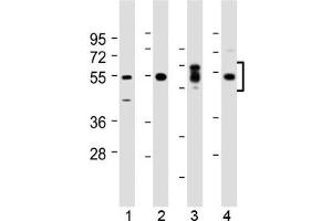 Western Blotting (WB) image for anti-serum/glucocorticoid Regulated Kinase 1 (SGK1) (N-Term), (Ser78) antibody (ABIN5647813)