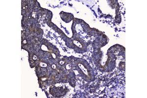 Immunohistochemistry (IHC) image for anti-Cytochrome C Oxidase Subunit IV Isoform 1 (COX4I1) (AA 59-169) antibody (ABIN5692827)