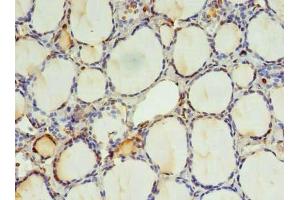 Immunohistochemistry of paraffin-embedded human thyroid tissue using ABIN7151410 at dilution of 1:100 (KIAA0494 抗体  (AA 1-483))